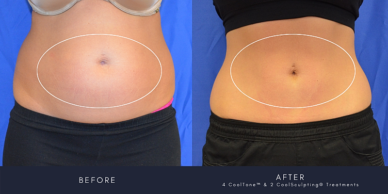 Cooltone Before & After